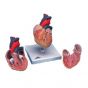 Klasyczny model serca, 2 części G08