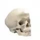 Model czaszki człowieka z wodogłowiem A29/2