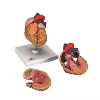 Model serca z przerostem lewej komory G04