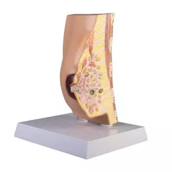 Model przekroju przecznego chorej kobiecej piersi Erler Zimmer