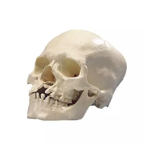 Model czaszka z rozszczepem szczęki i podniebienia A29/3