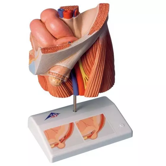 Model przepukliny pachwinowej H13